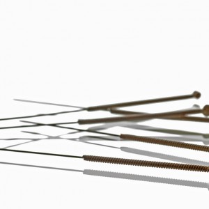 Acupuncture needles made of stainless steel