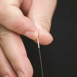 Insertion of Acupuncture Needle - Toronto Acupuncture Clinic